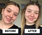 Before and After Photo |
